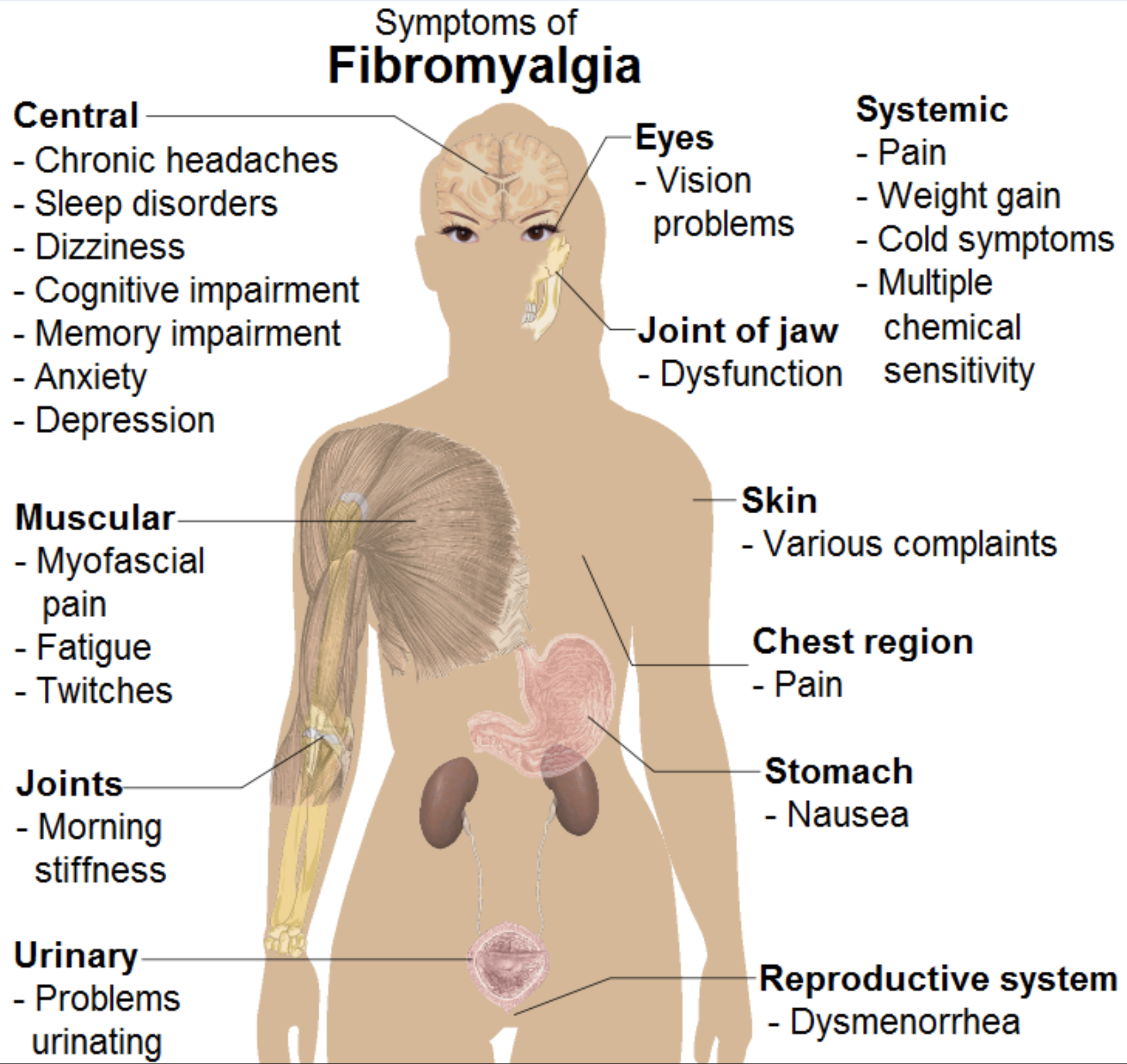 What Is Meant By Myalgia